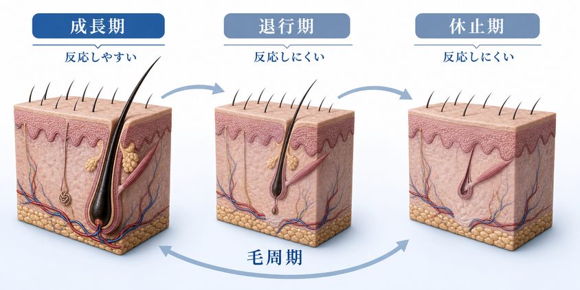 ヒゲの毛周期を成長期・退行期・休止期に分けて示す図解